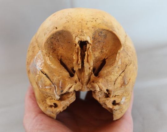 craniu extraterestru Peru 1