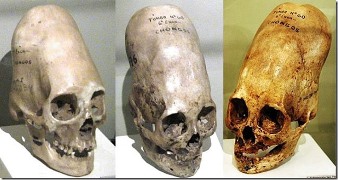 A fost descifrată enigma craniilor alungite incaşe, care se aseamănă cu craniile "extraterestre"?
