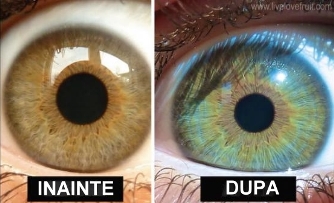 O femeie şi-a schimbat culoarea ochilor, după ce a ţinut o dietă cu alimente crude (raw)! Acum are ochi mai frumoşi, vede mai clar şi este şi detoxifiată!