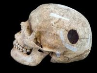 Un craniu din secolul al IX-lea, cu o deschidere chirurgicală, sugerează că vikingii făceau operaţii intracraniene în urmă cu 1.200 de ani
